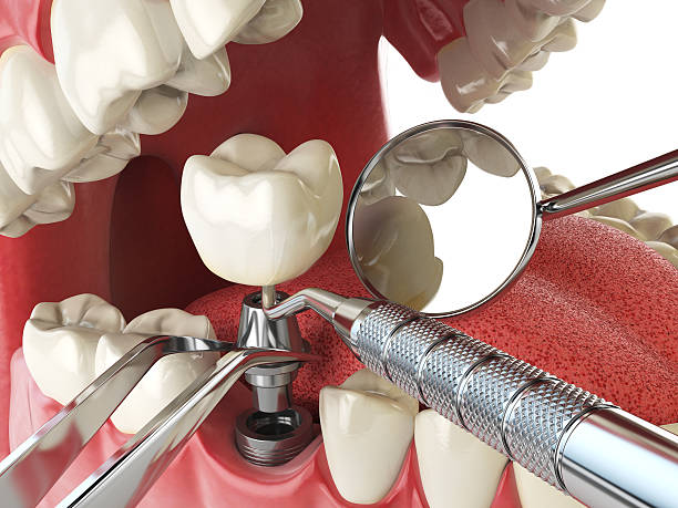 Best Dental Abscess Treatment in Brices Creek, NC